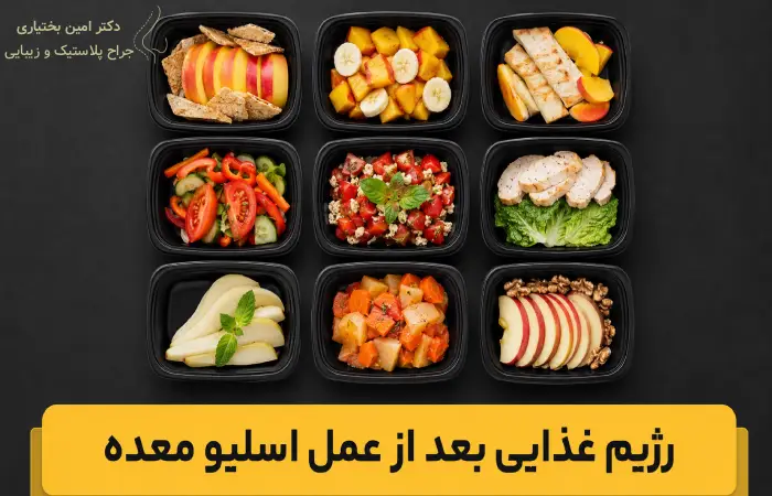 رژیم غذایی بعد از اسلیو معده